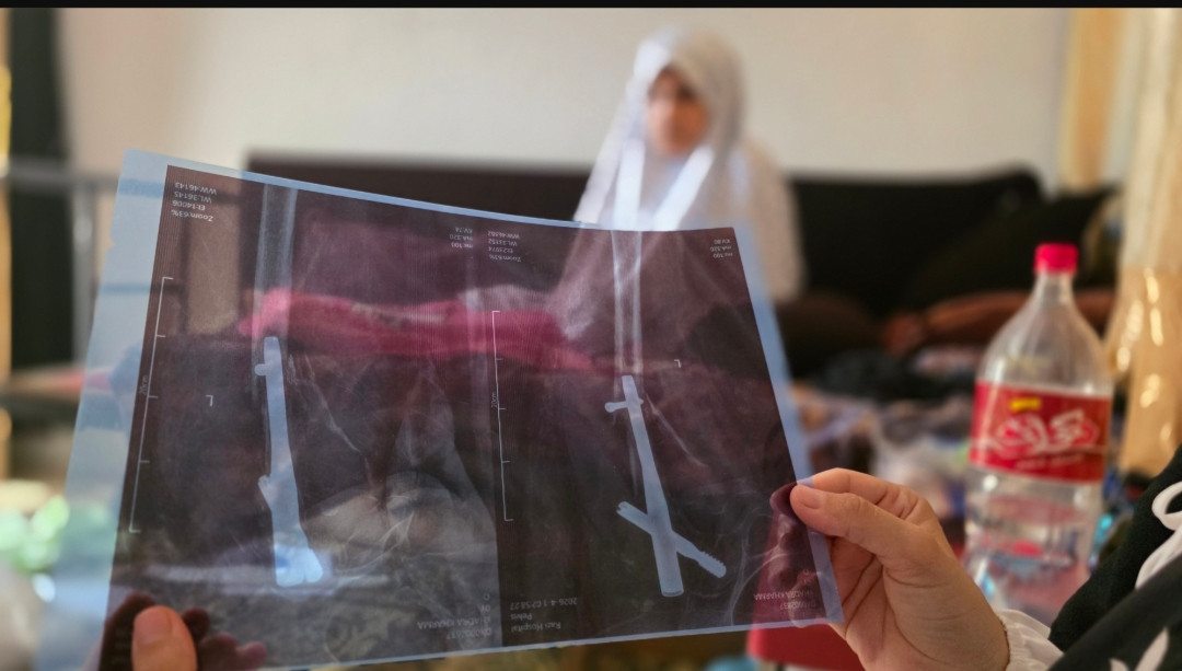 خضرة… باعت بيتها لتكمل علاجها