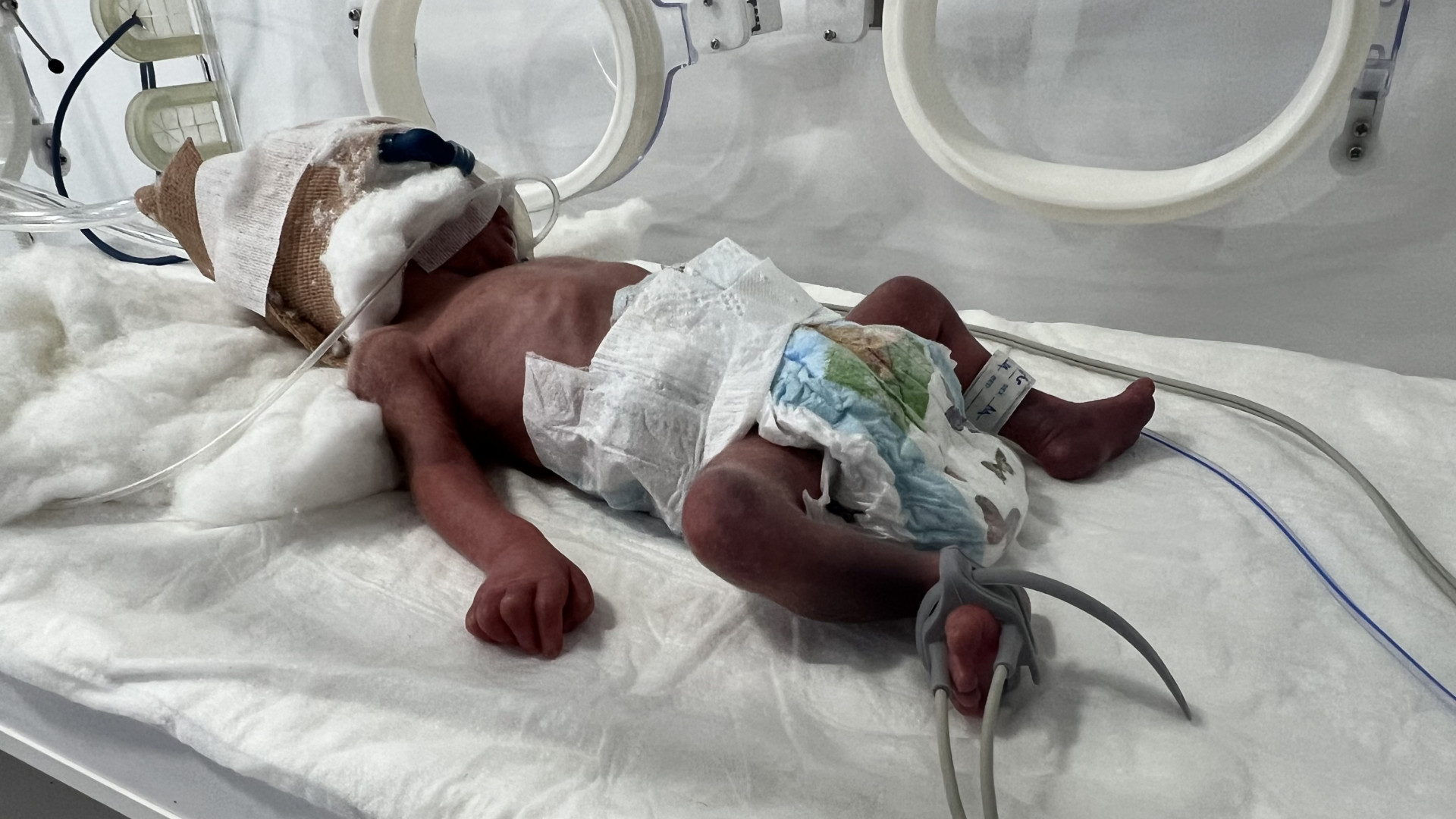 Ali needs someone to ease his pain and grant him a healthy and dignified life.
