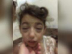 kid with infection destroying her eyes