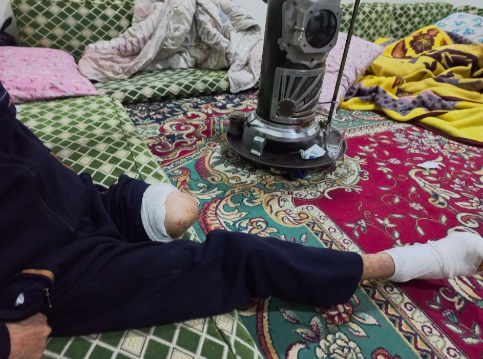 Due to diabetes complications, his foot was amputated, and he no longer can provide for his family.