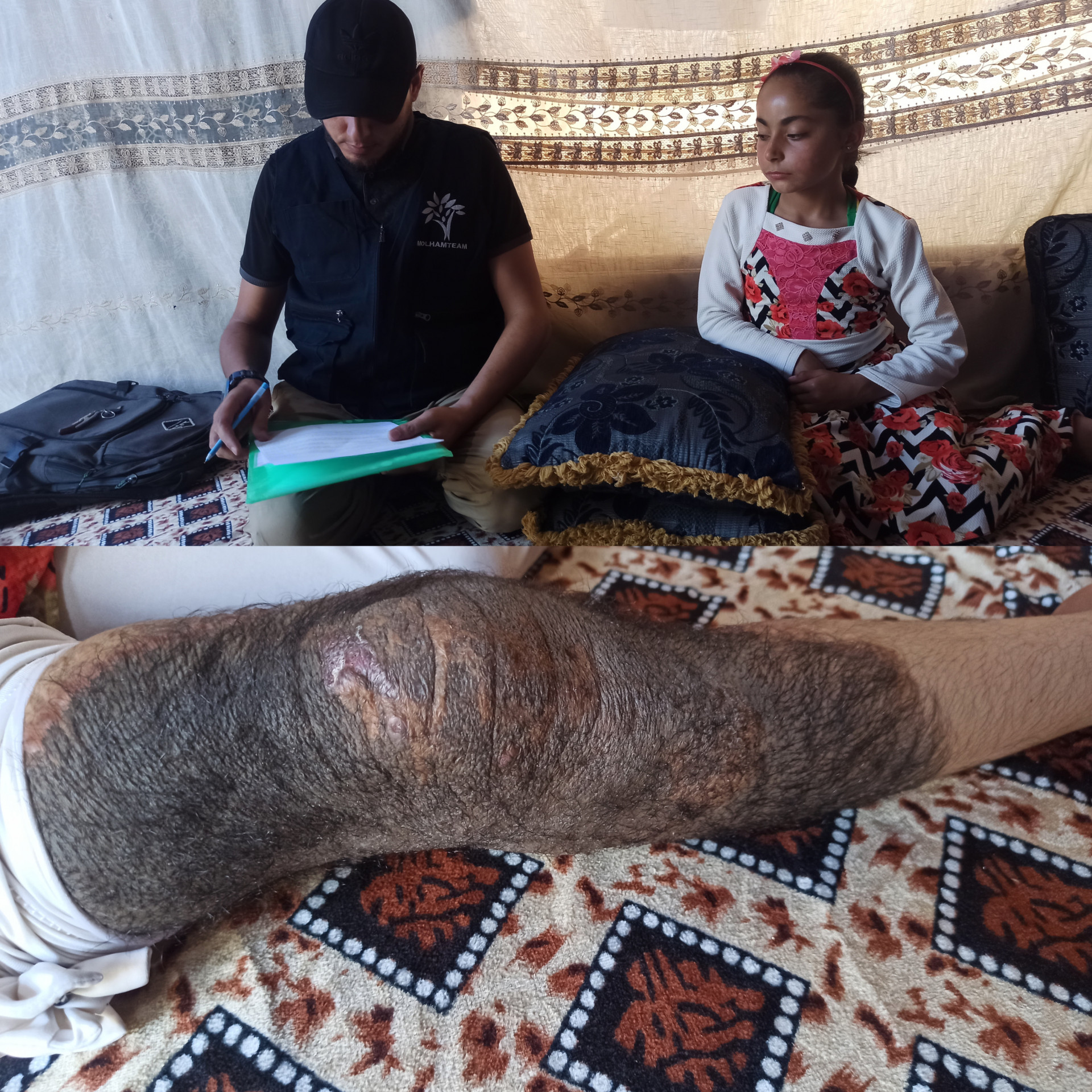 Hiba was born with a birthmark over her body! Help her get rid of it!