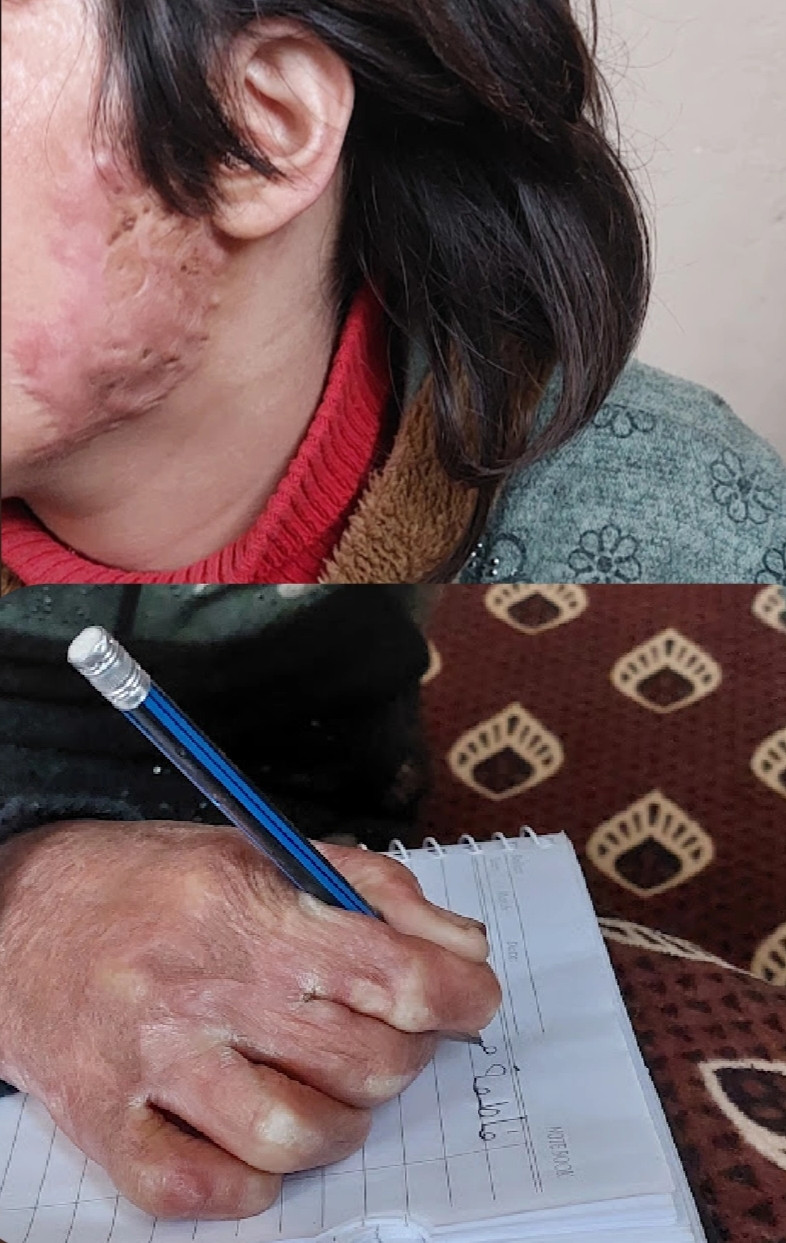 Help Fatima Heal and Smile Again