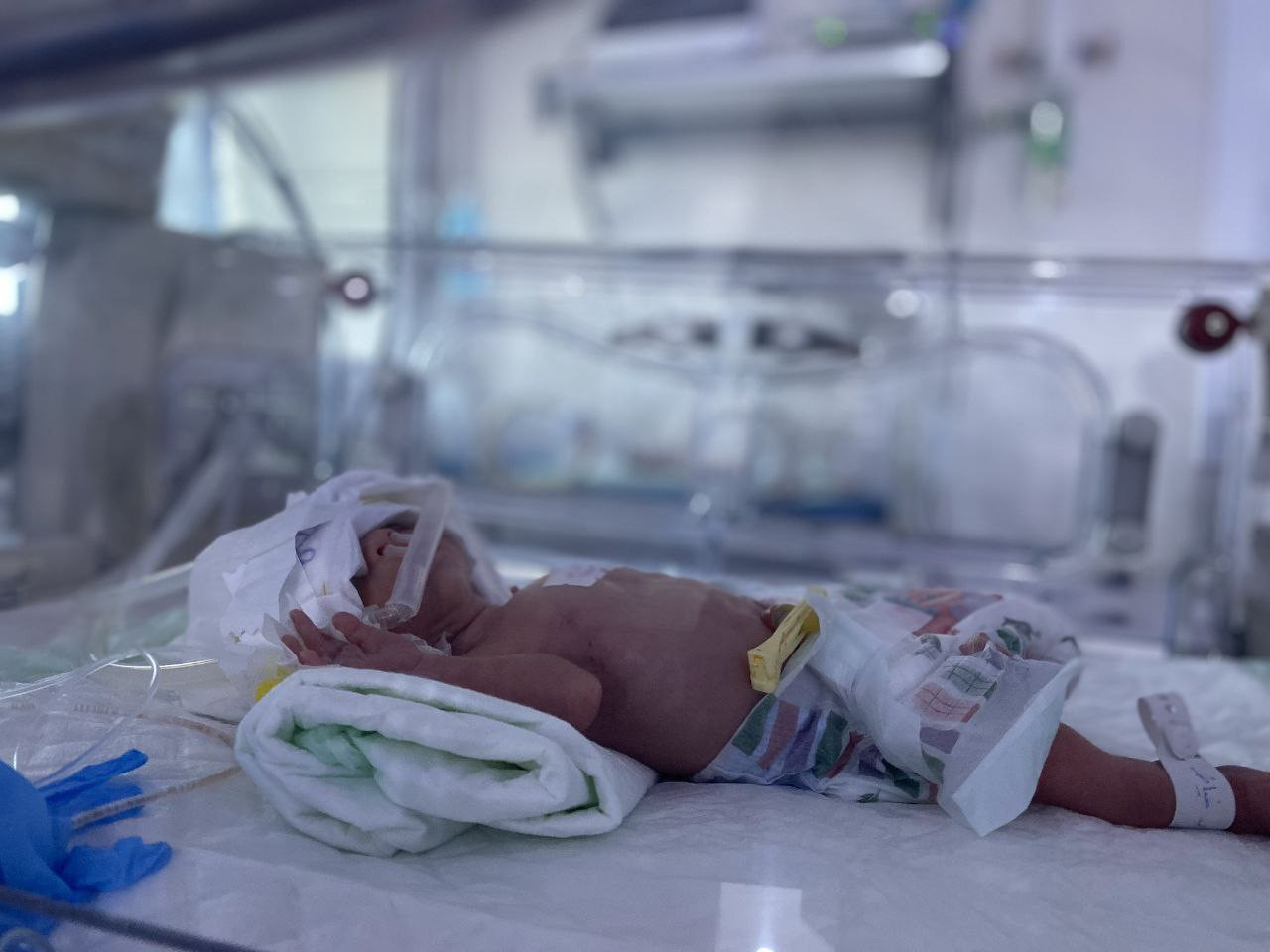 Your donations to our child Mustafa will help him survive