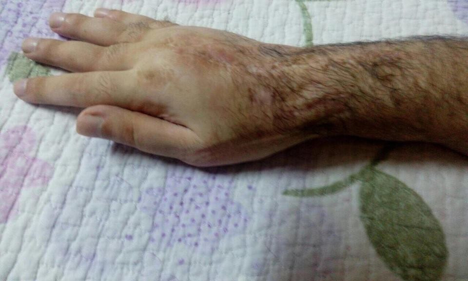 A patient needs a surgery