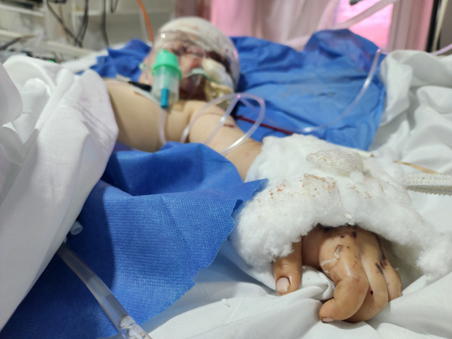 مخلّفات الحرب خطفت منهم أرواحاً!