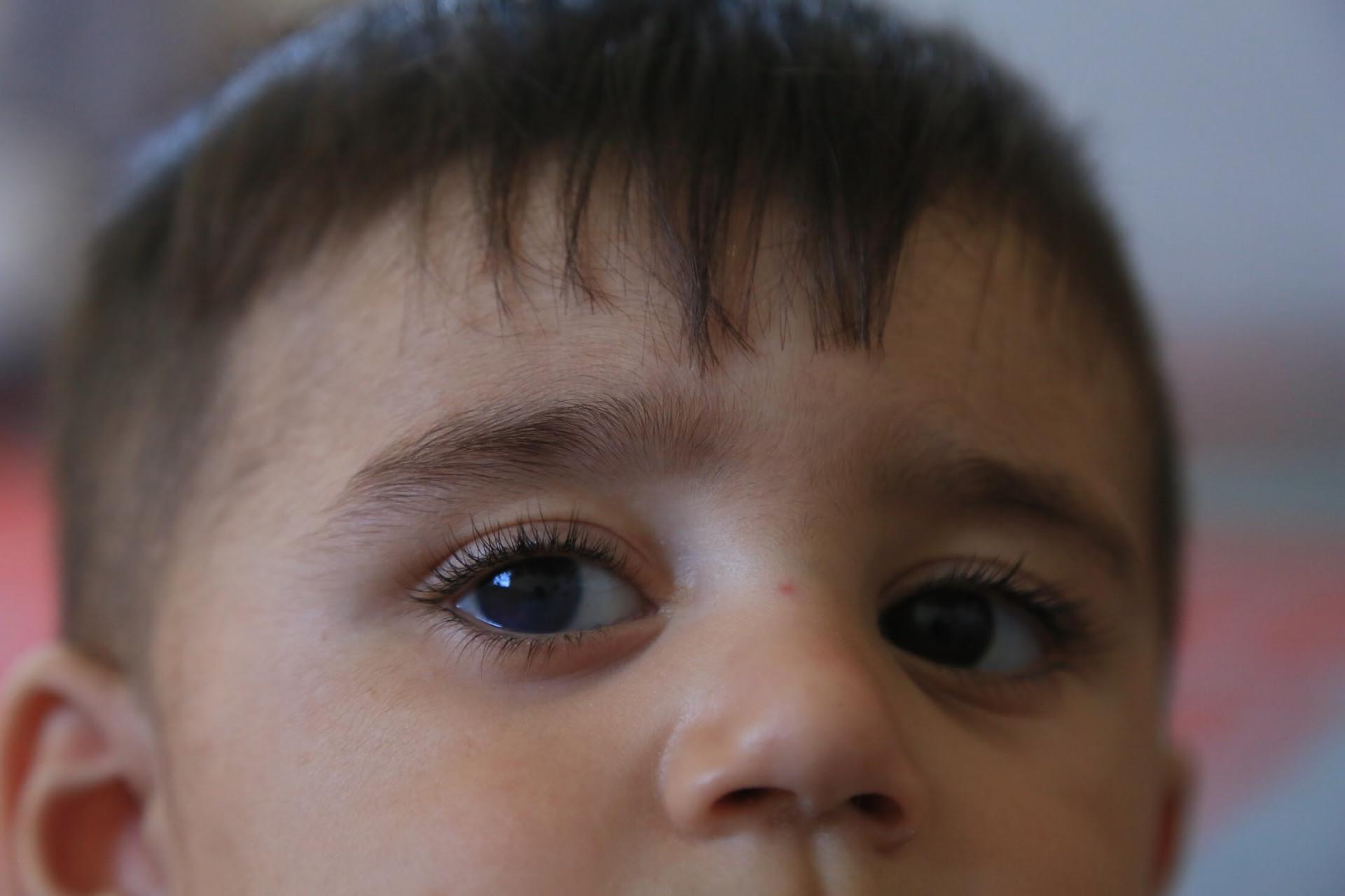 A child at risk of being blind