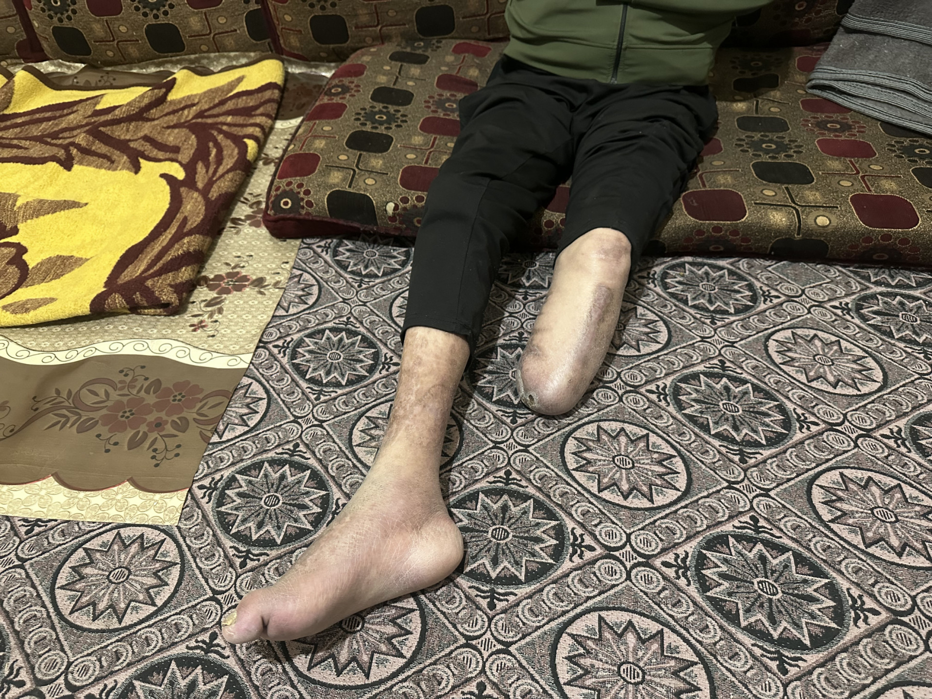 العم يحيى فقد ساقه!