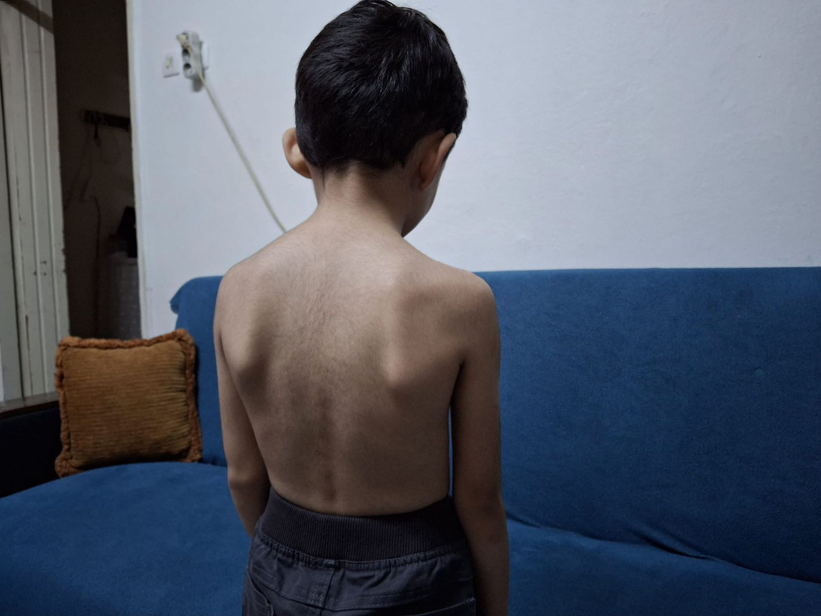 Baby Ahmed Breathe Without Pain