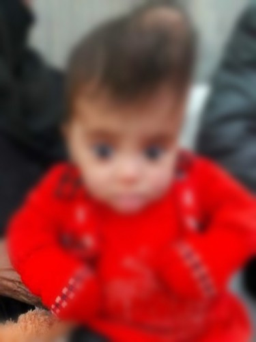 A child needs treatment costs