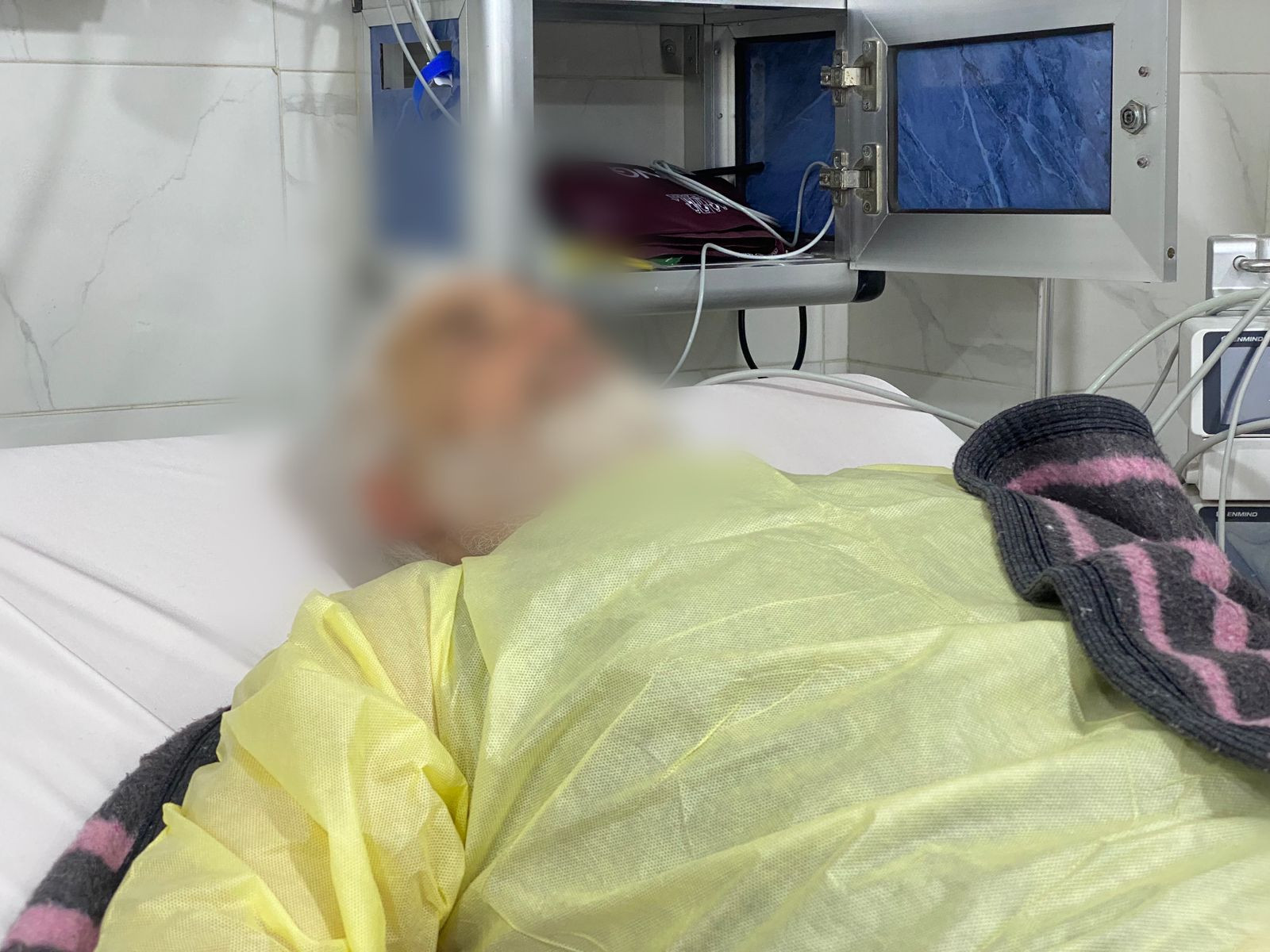 Urgent Need for Stent Placement Surgery