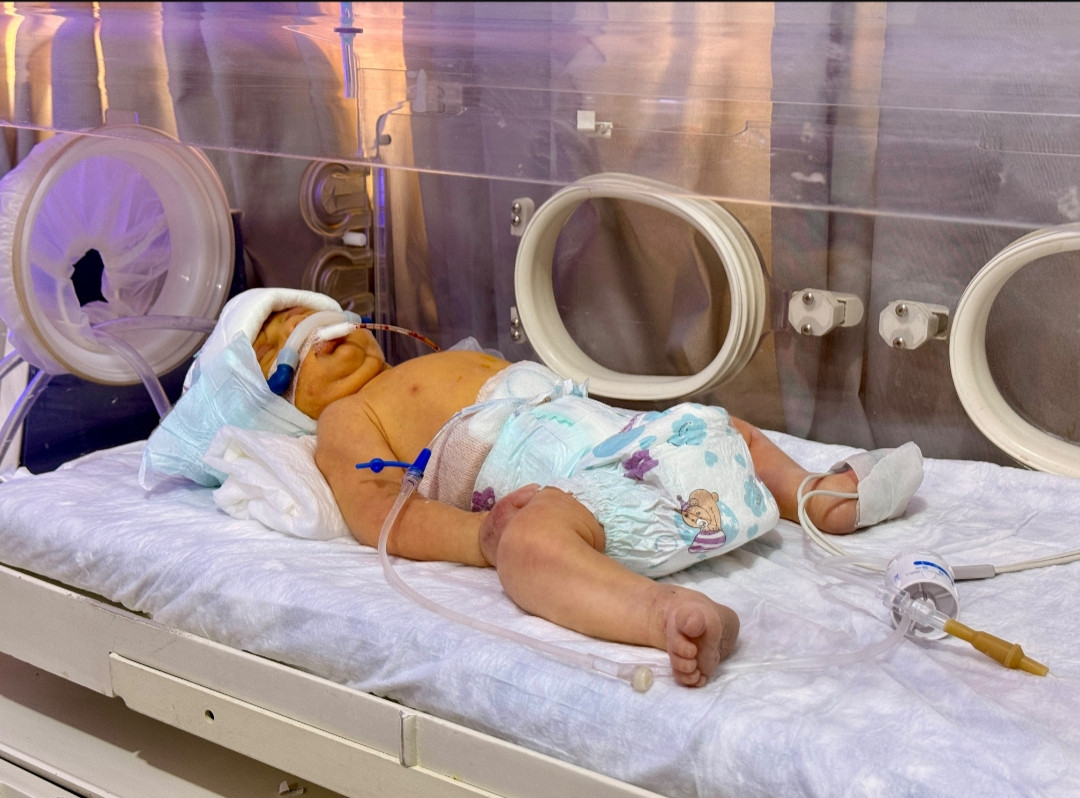 منذ ولادته.. عمر يكافح صعوبة التنفس