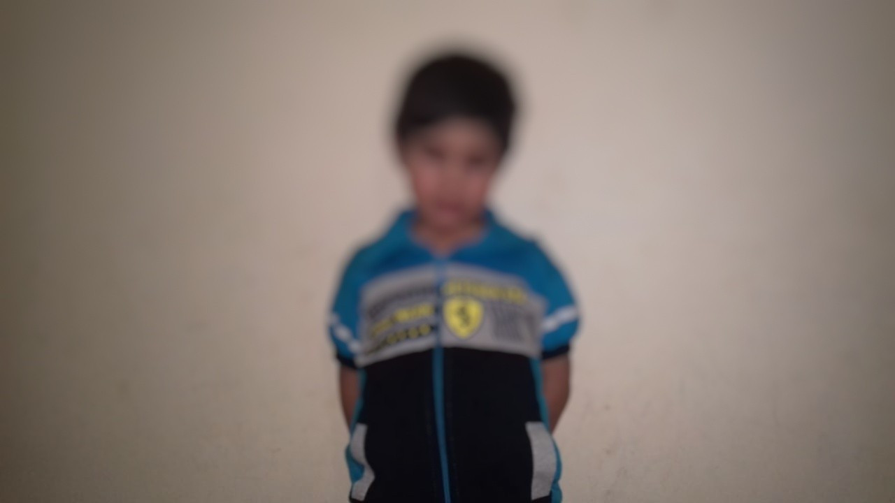 A child suffres of cataract