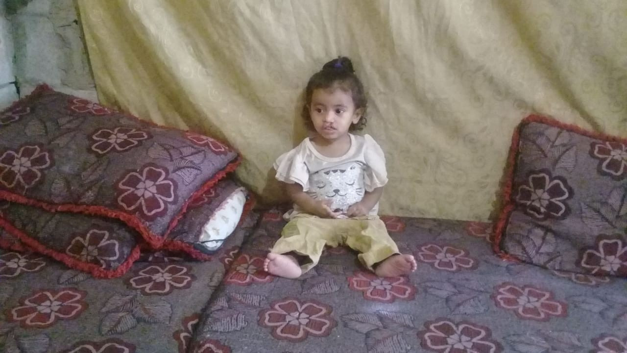 طفلة تحتاج إلى عملية