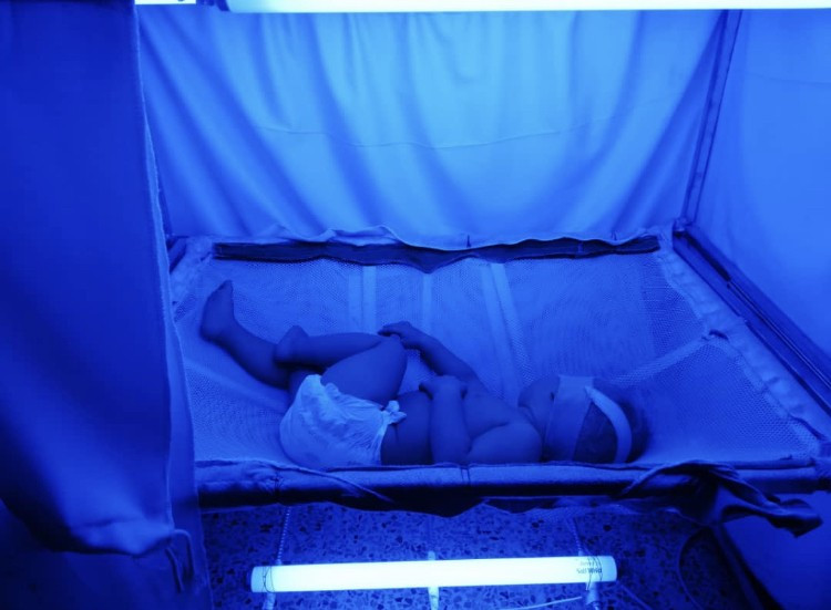 A baby with jaundice in need of medical supplies and medicines