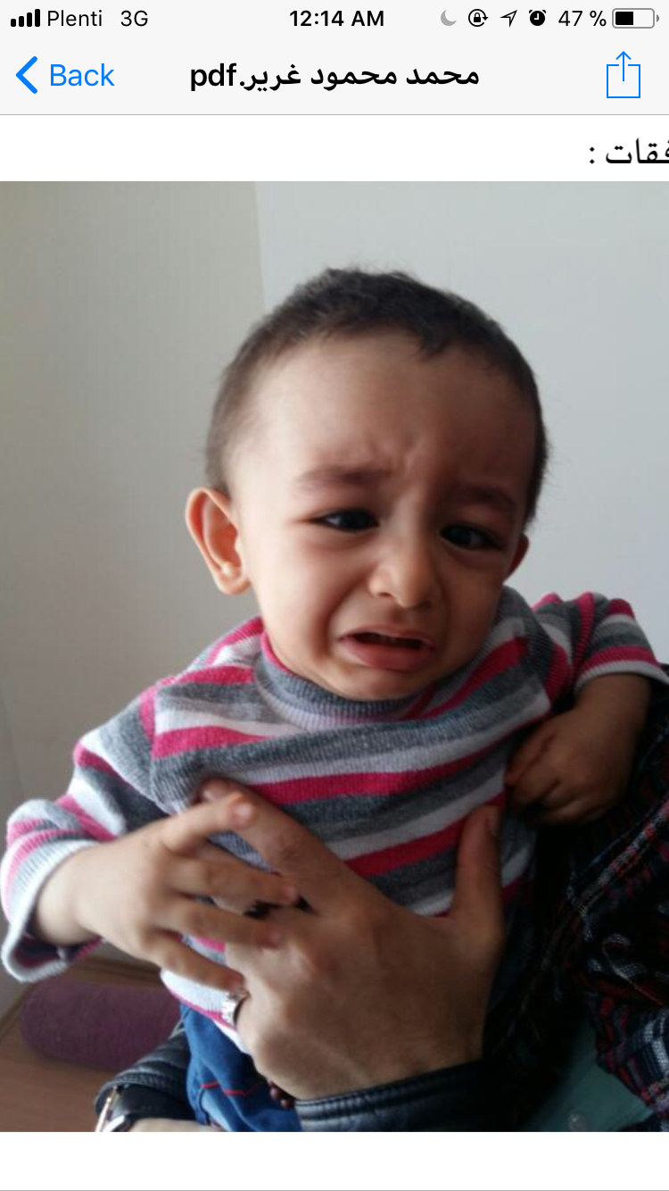 newborn needs treatment