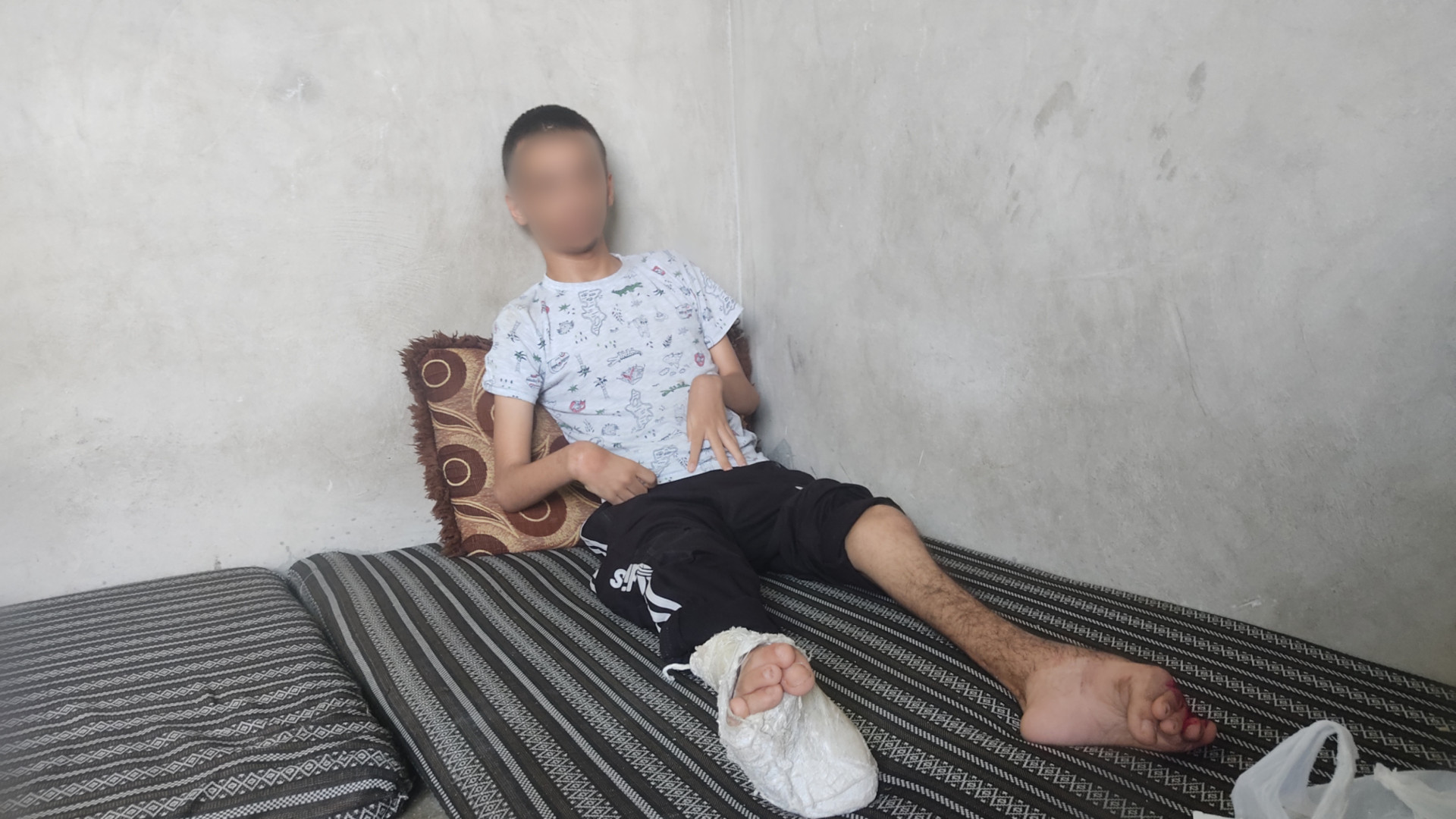 The family of the young Izzo consists of 12 people, and their living situation is very bad.