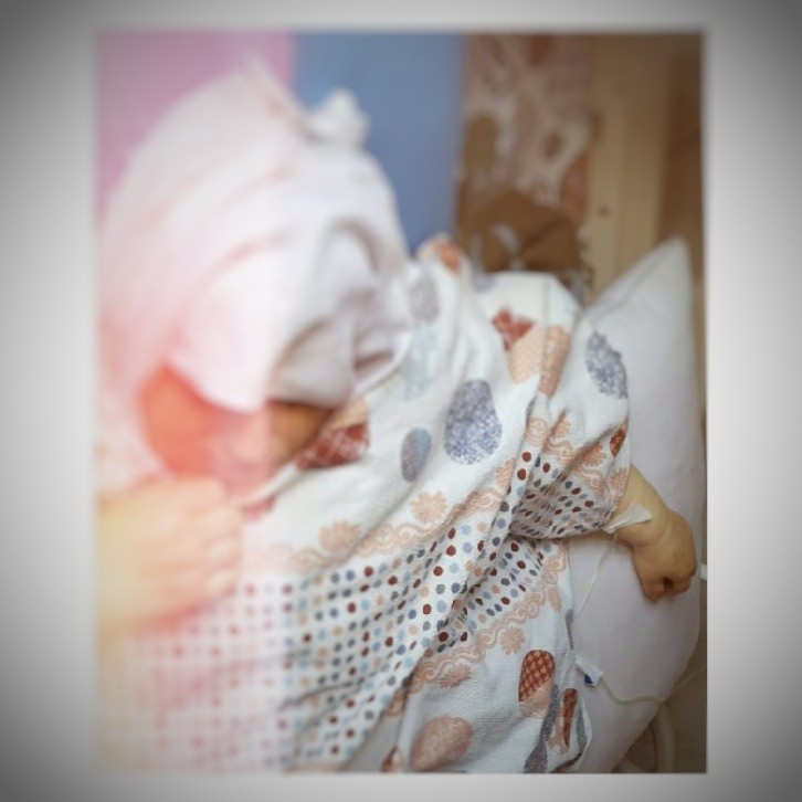 A woman with severe vertebral disc herniation