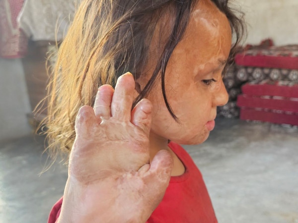 Urgent Humanitarian Cases !