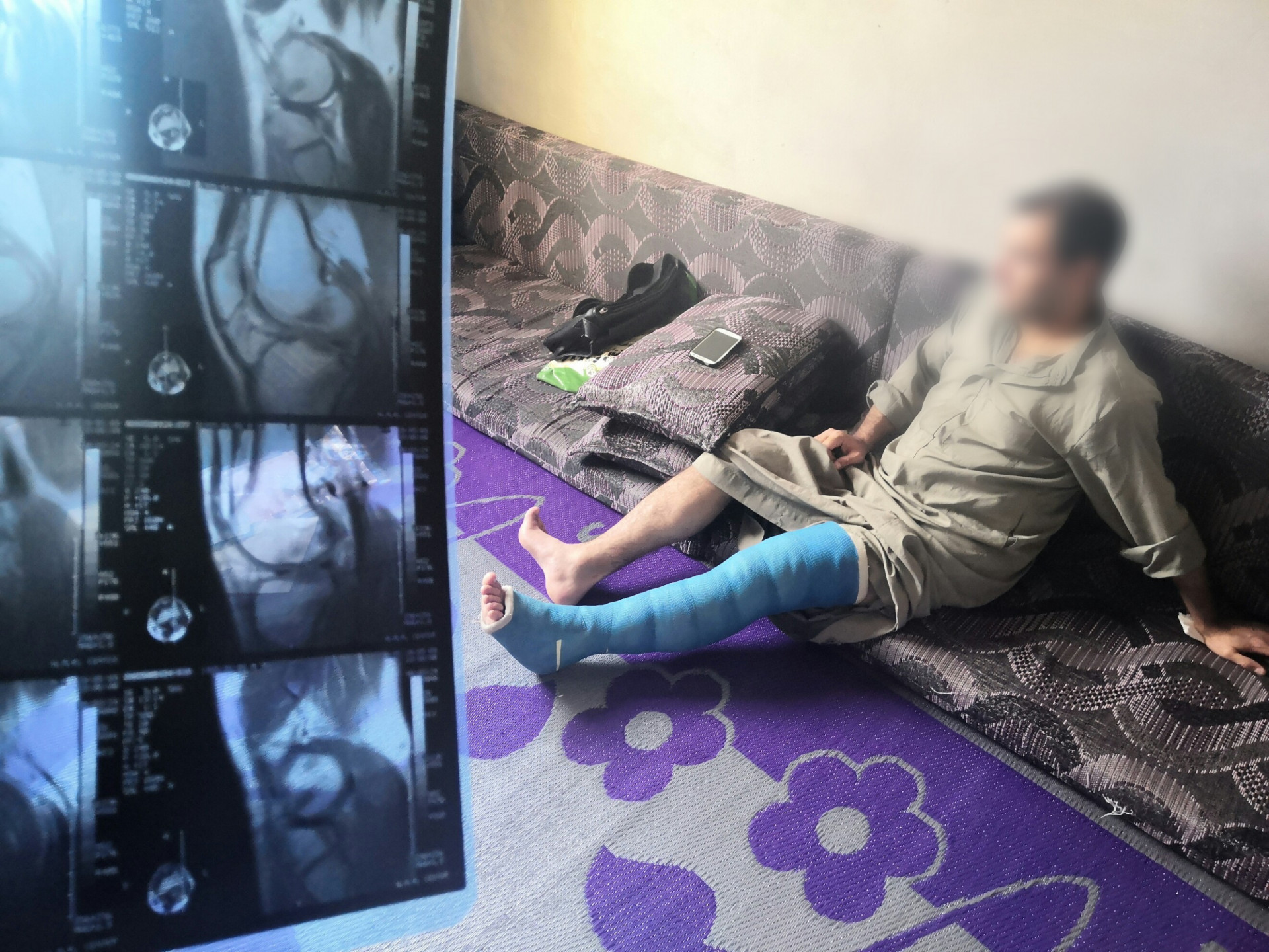 A man injured during displacement