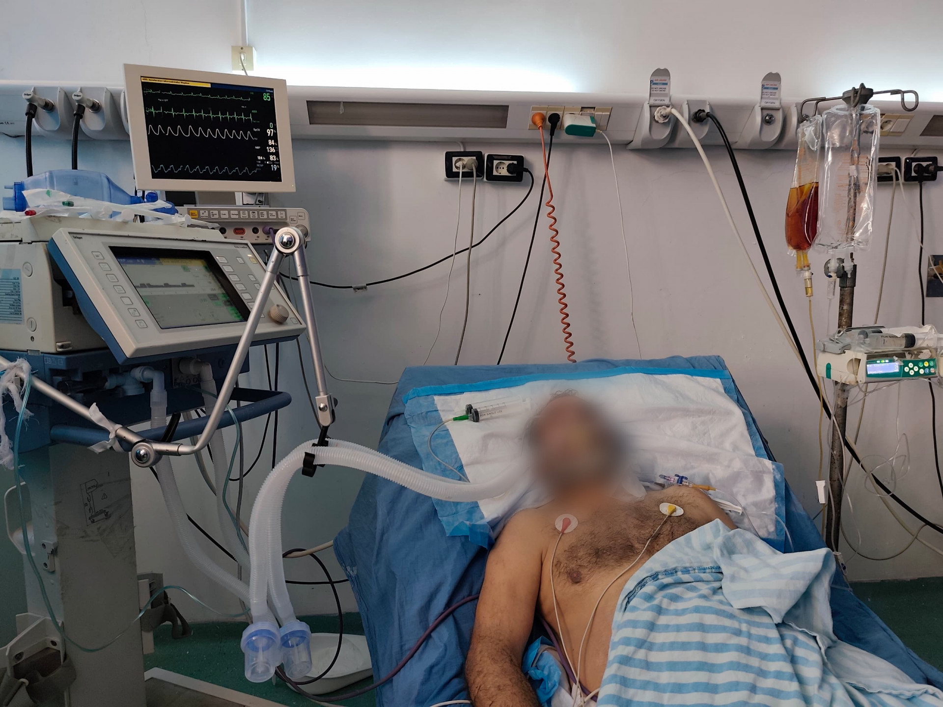 شللٌ جعلهُ بين الحياة والموت