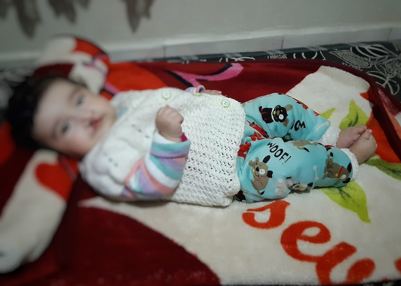 A newborn with cleft palate, needs surgeries