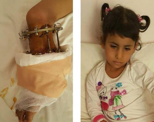 Medical Assistance for a Child