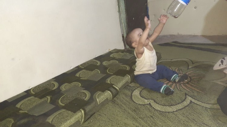 طفل يعاني من وجود كتلة بحاجة استئصال