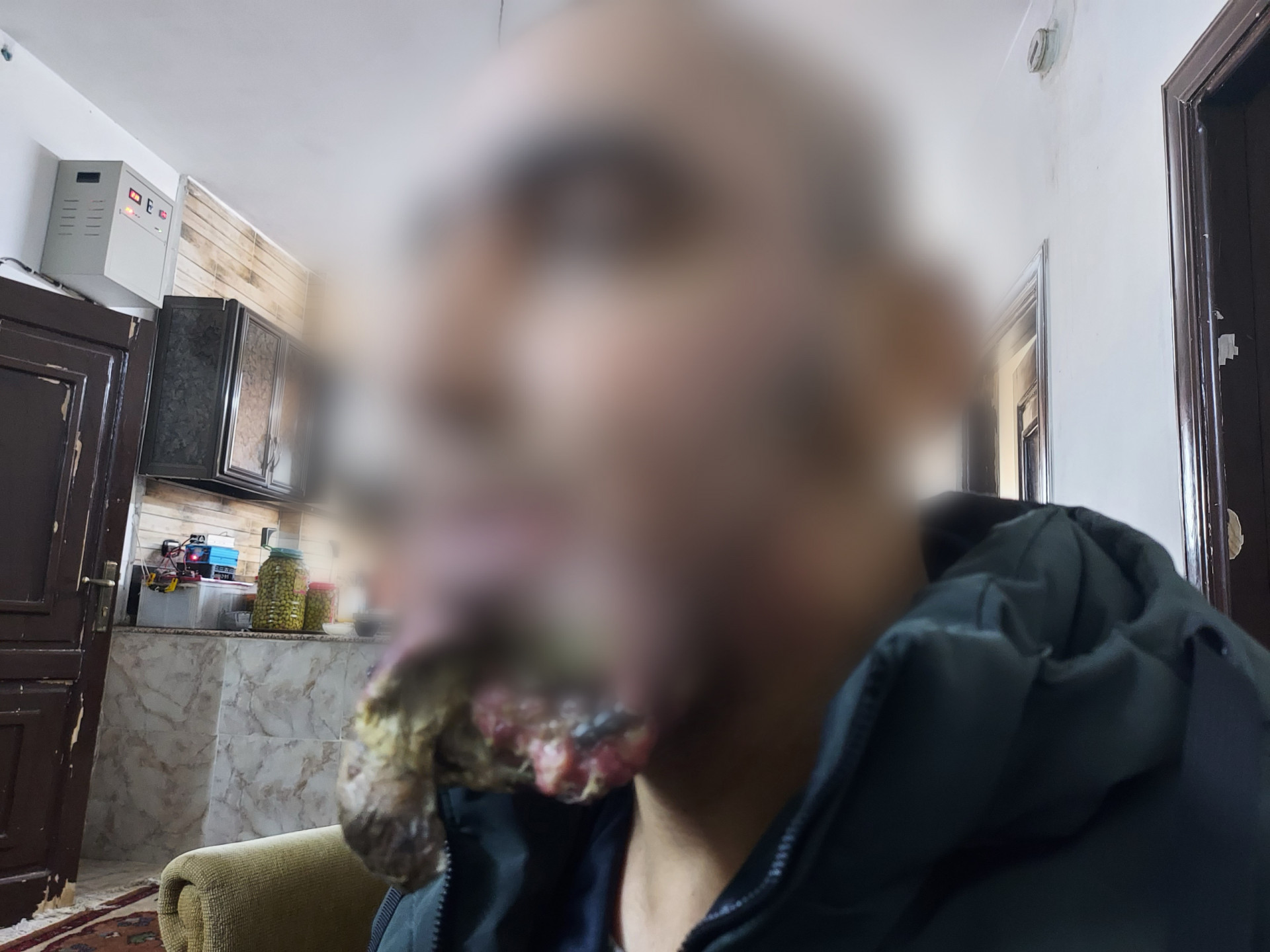 Mohammad was diagnosed with cancer and his life turned upside down!