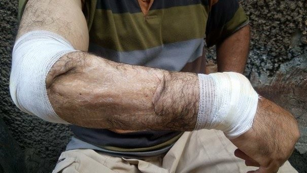 Patient needing surgery expenses