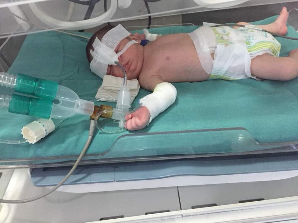 Immediate NICU admission is needed for a newborn