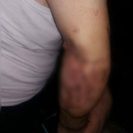 Surgery for a Syrian Patient