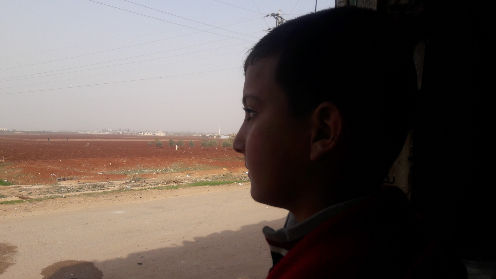 A child in need for eye surgery