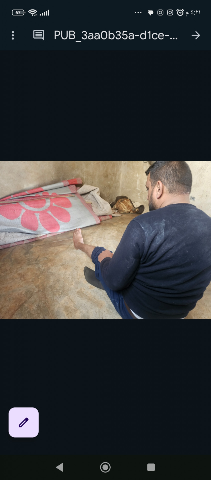 إعاقةٌ دائمة أثناء تأديته واجبه الإنساني