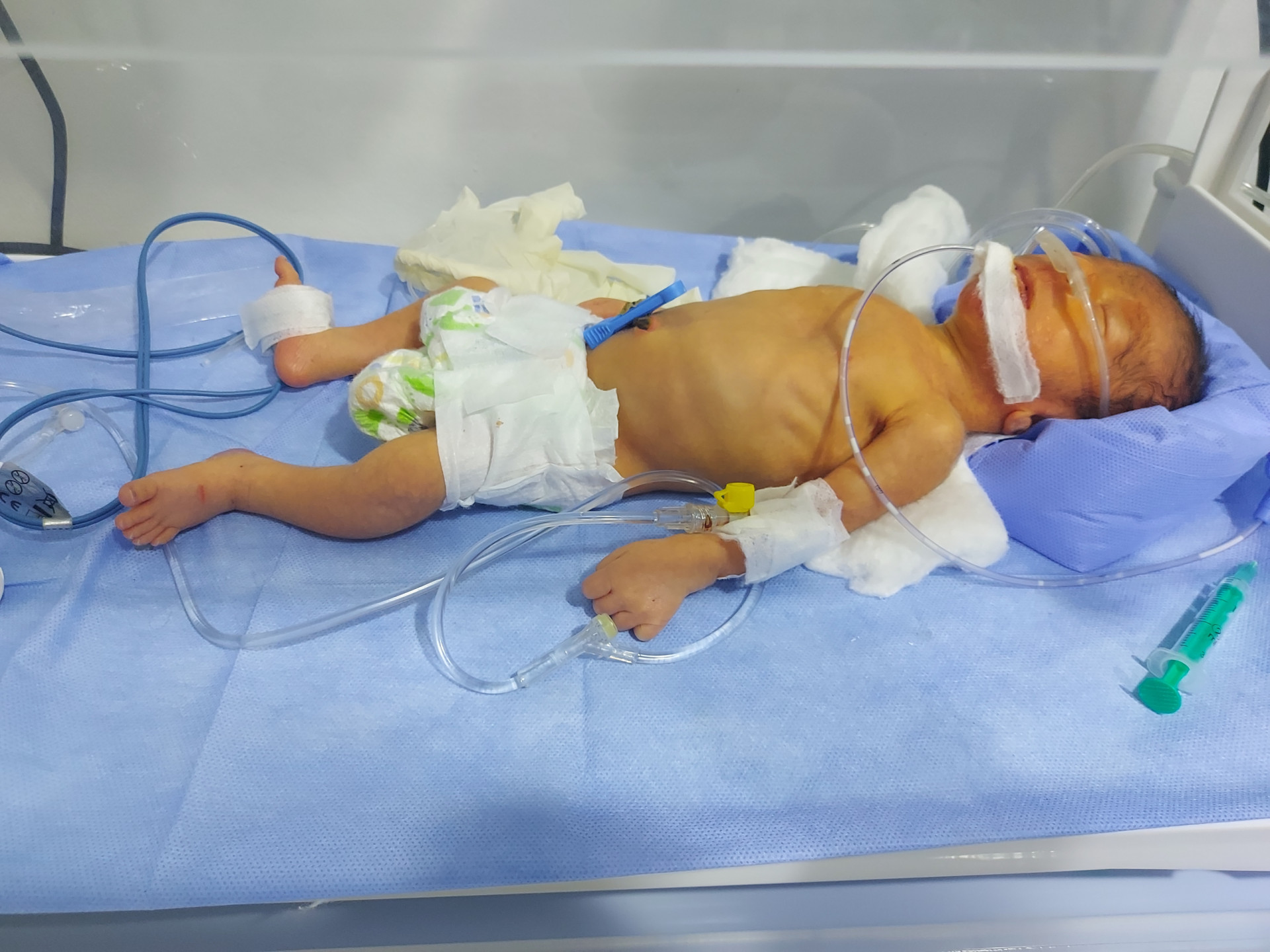 Their first child needs urgent help!