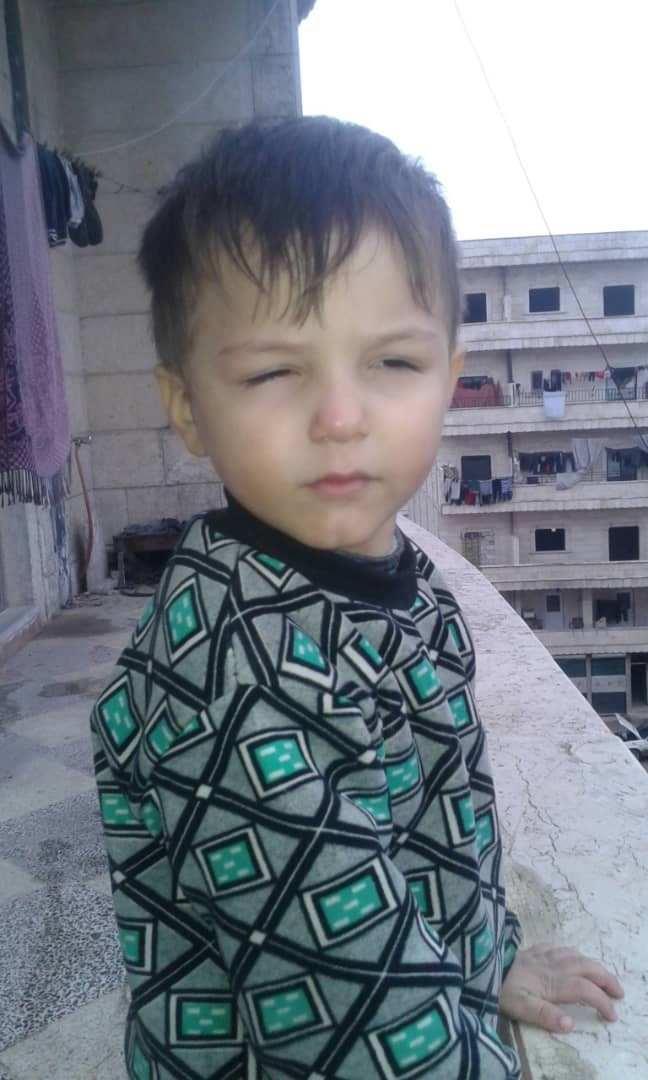 A baby suffers from Phengophobia!