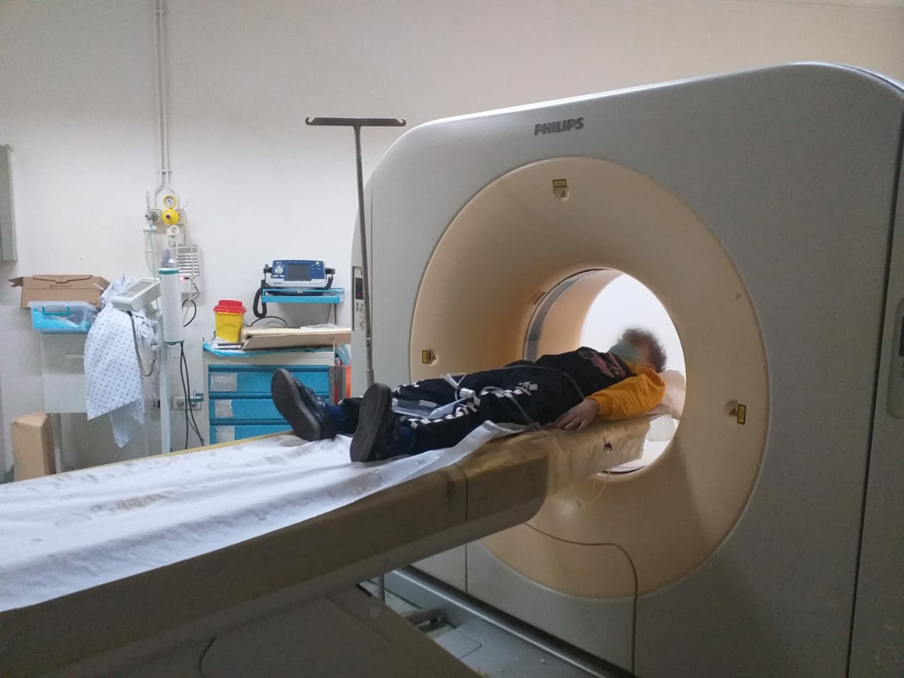 A little child is with acute pneumonia needs urgent treatment.