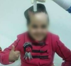 Medical Assistance for a Burned Child