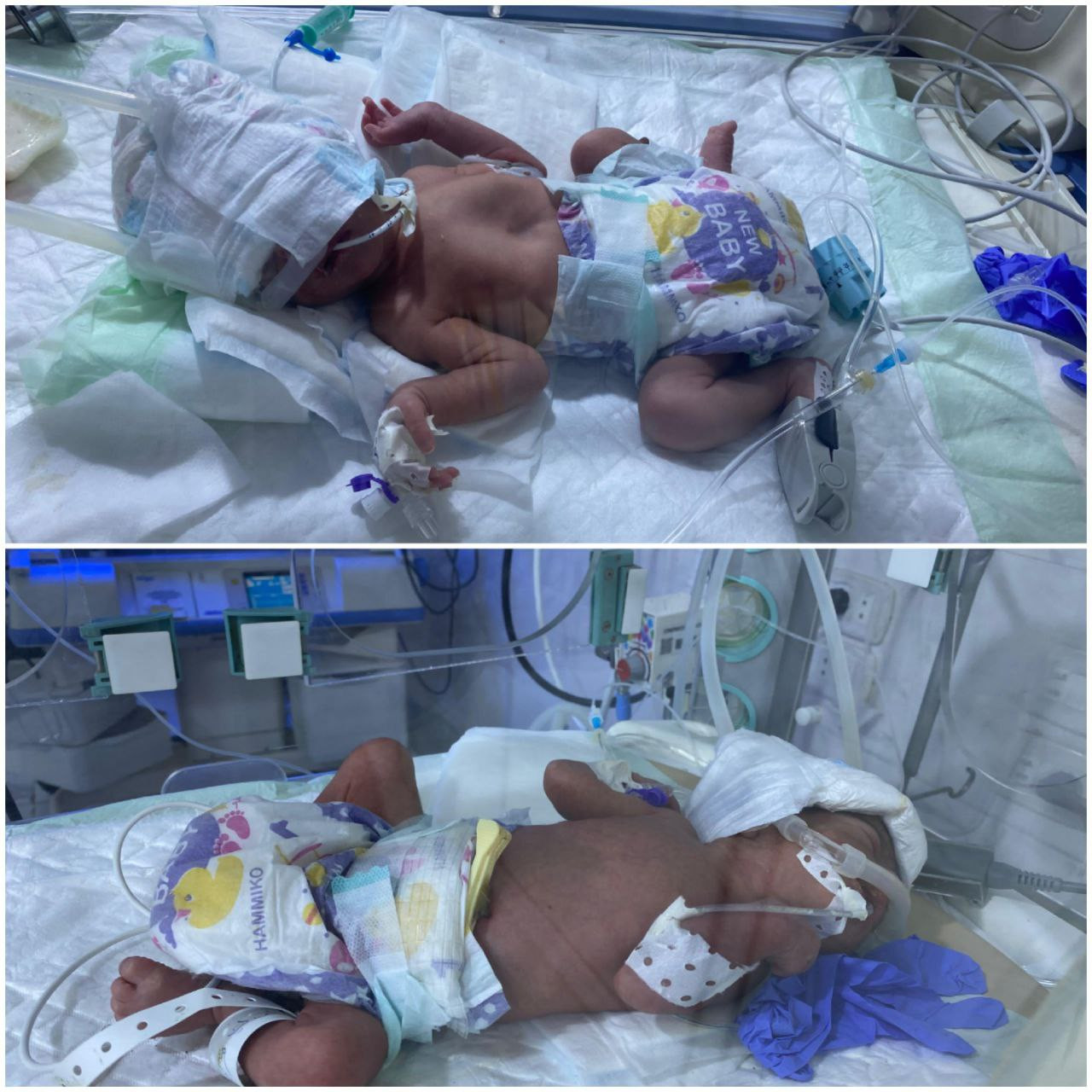 Two newborn babies need your support to help them breath and survive!