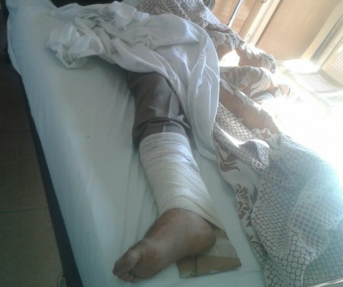 Refugee needing surgery
