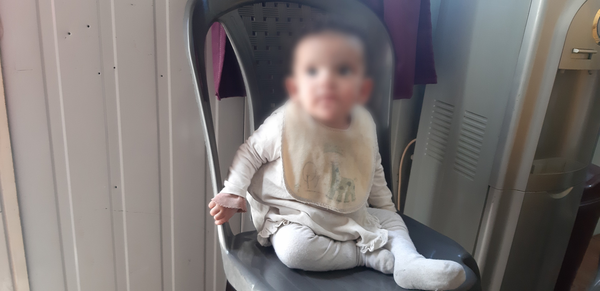 A baby girl needs surgery to be able to eat