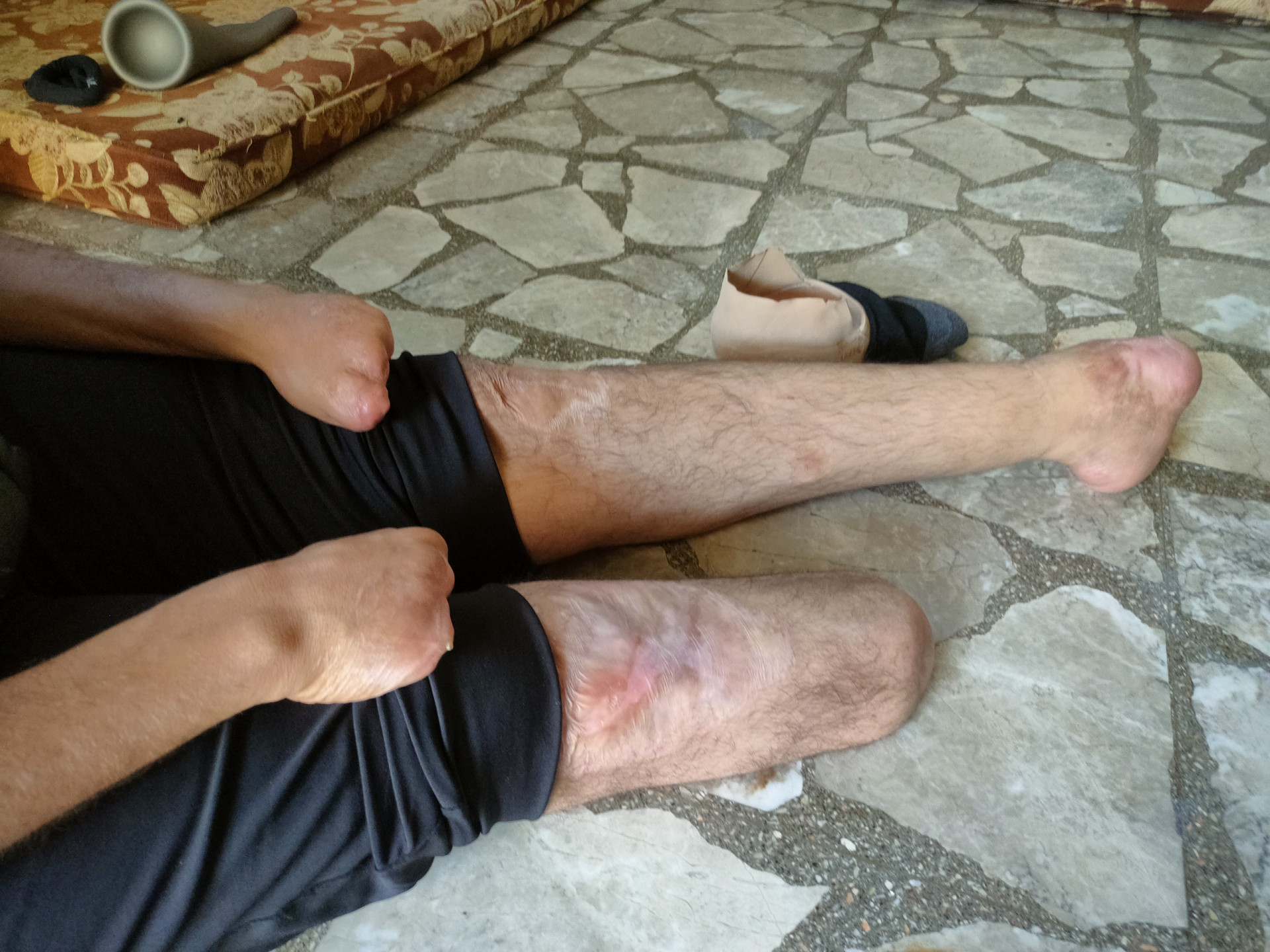 A bitter migration journey and painful suffering