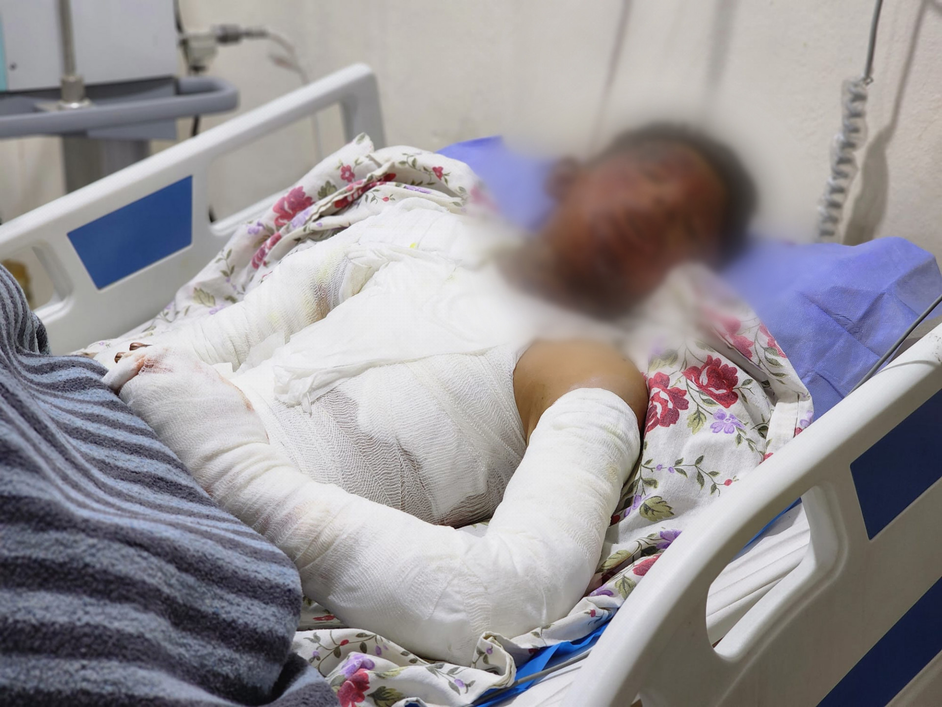 لم تدفئه نار المدفاة بل احرقت جسده