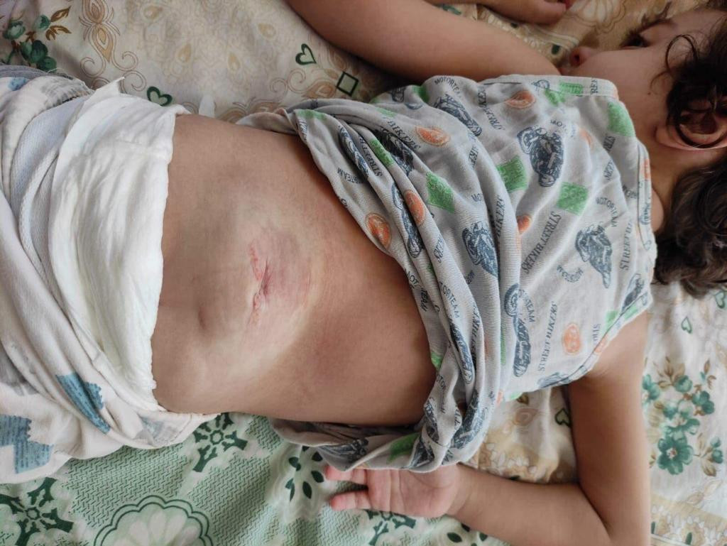 لن تحرر العملية عموده الفقري فقط،ستحرر قلبه من حزنه،ستحرر جسده من أوجاعه