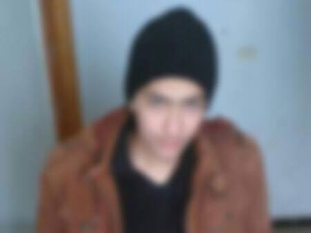 A child suffers from Hepatitis