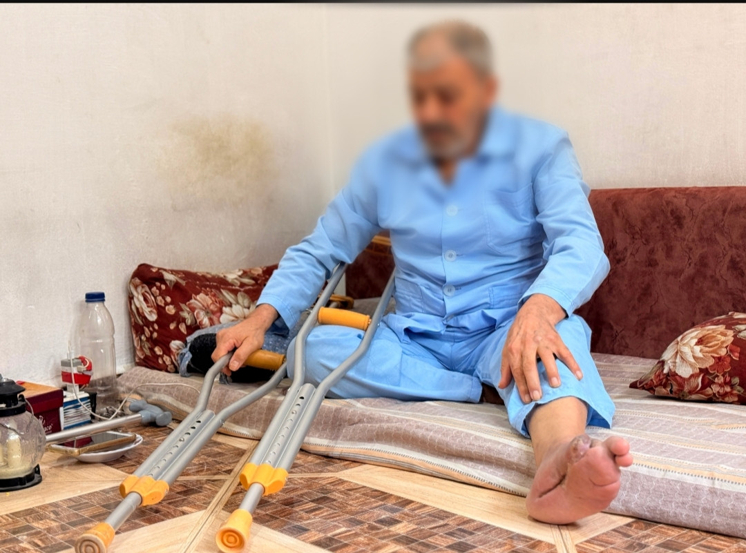 على وشك فقدان قدمه..