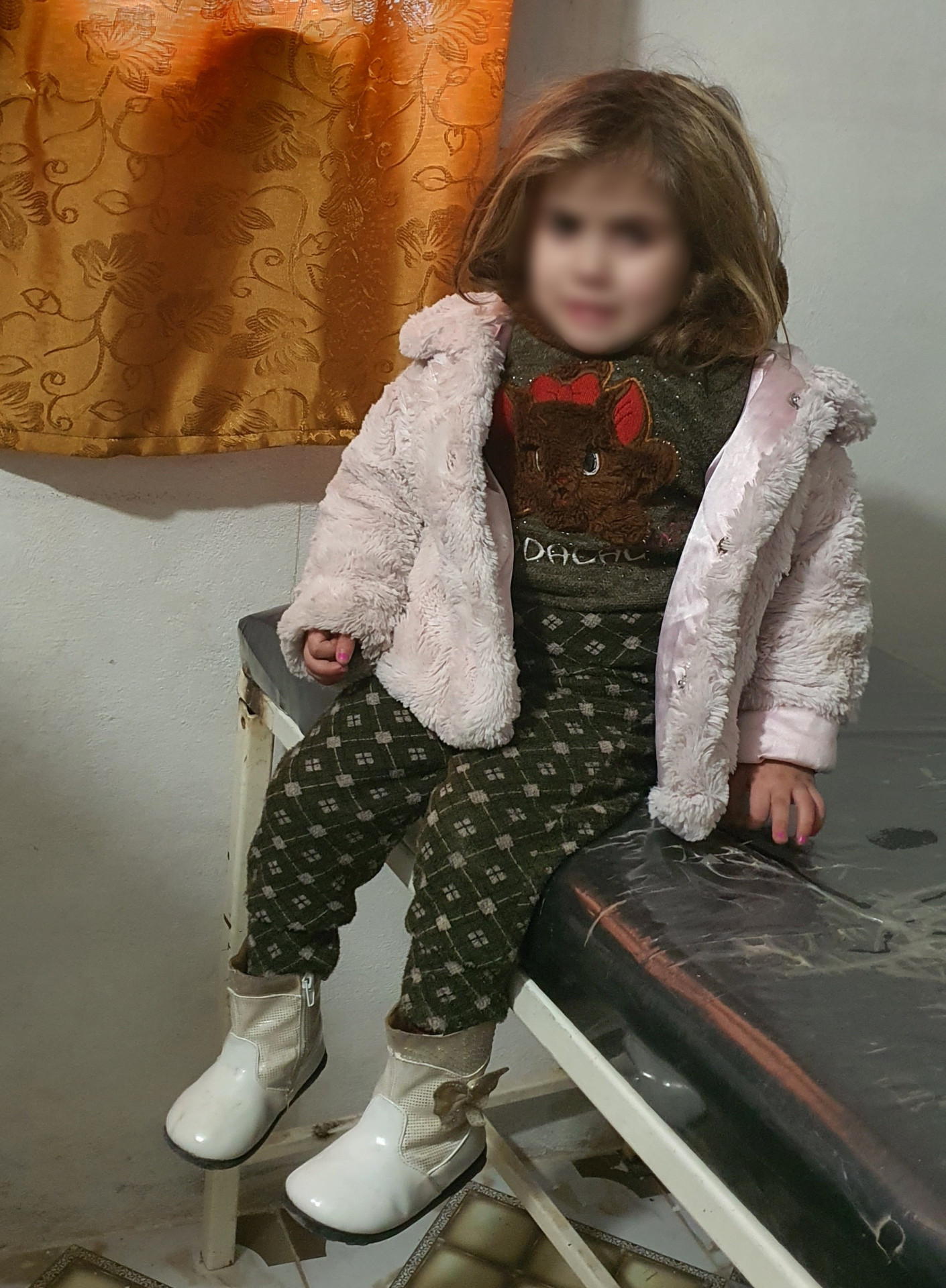 Sana'a is with hormone growth deficiency