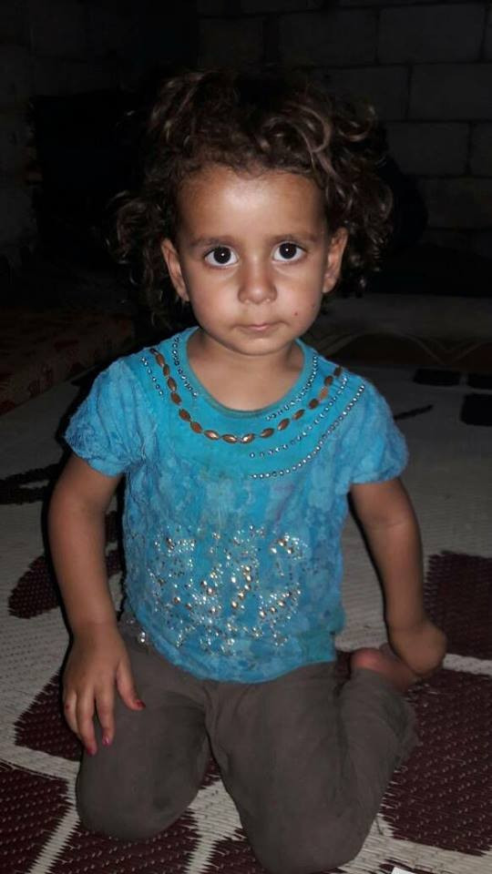 Child suffering from hemorrhagic disease
