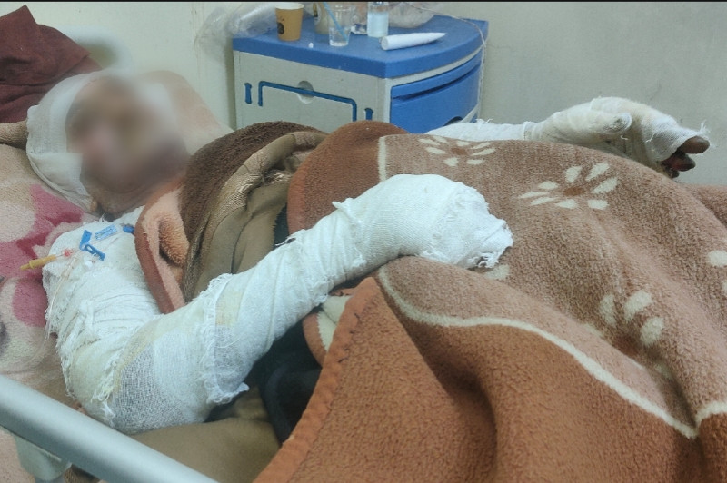 العم عمر… حروق وآلام تفوق الاحتمال