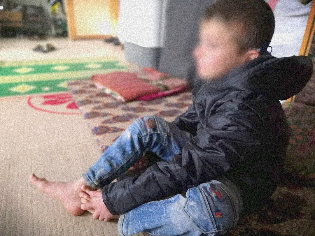 A child with hearing impairments needs medical aids