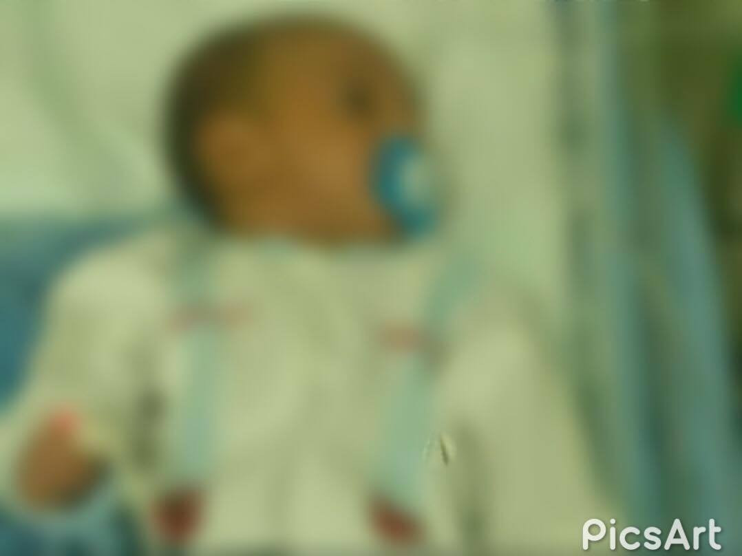 Child need admission to ICU
